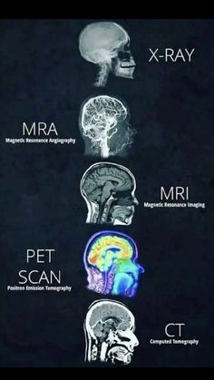 the different types of mris are shown in this graphic above it is an image of what they look like