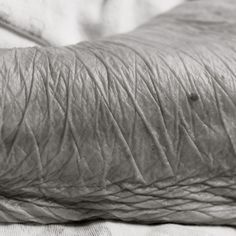 an old photo of someone's arm with wrinkles on it and the skin is wrinkled