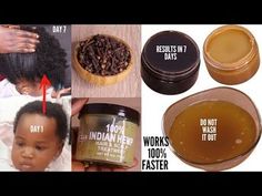 Growing Back Edges, Indian Hemp Hair Growth, How To Grow Natural Hair Black Women, Alopecia Hair Growth, Indian Hair Care, Thicken Hair Naturally, Big Natural Hair, Black Hair Growth, Hair Growth Foods