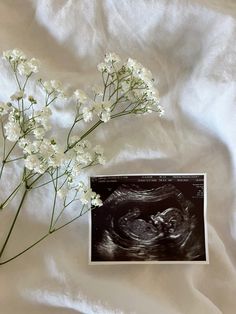 some white flowers on a white sheet and an x - ray image in the middle