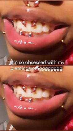 two pictures of the same person's teeth with braces and piercings on them