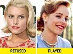 before and after photos of the same woman's face in different stages of plastic surgery