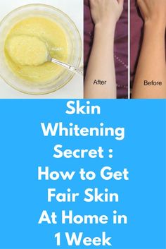 15 Easy Homemade Face Packs For Oily And Acne-Prone Skin Natural Skin Exfoliator, Get Fair Skin, Skin Exfoliator, Tan Removal, Whitening Face, Dead Cells, How To Exfoliate Skin, Whitening Cream