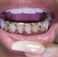 a close up of a person's mouth with gold teeth and braces on it