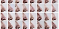 multiple images of different stages of nose surgery, including the upper lip and lower lip