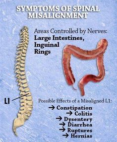 Health begins in the Colon.  A misalignment of the L1 vertebrae in the lower back affects the intestinal tract, resulting in possible constipation, diarrhea, or colitis. Hemorrhoids have also been linked to misalignment of the coccyx (tailbone). ‪#‎chiropractic‬ ‪#‎nervousystem‬ ‪#‎loveyourspine‬ ‪#‎colon‬ ‪#‎constipation‬ ‪#‎colitis‬ ‪#‎diarrhea‬ ‪#‎hernias‬ ‪#‎dysentery‬ ‪#‎ruptures‬ ‪#‎happyhumpday‬ ‪#‎L1vertebrae‬ Meal Replacement Protein Shakes, Human Body Structure, Green Drink