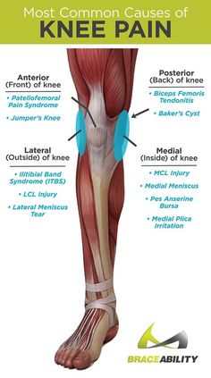 Types of knee pain and what causes anterior, posterior, medial and lateral knee pain problems Nerve Pain Relief, Knee Pain Relief, Yoga Iyengar, Sciatic Nerve, Knee Injury, Nerve Pain