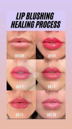 👄 Look at this lip blush healing journey! 💄✨ Lips will look divine at the end with just the right hint of colour. #LipBlush #HealingProcess #NaturalBeauty #LipTint #GorgeousLips #BeautyTransformation" Lip Blush Healing Process, Healing Process, Healing Journey, Lip Tint, To Shine