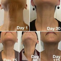 Collagen Broth, Collagen Elixir, Benefits Of Collagen, Collagen Skin Care, Short Hairstyles Over 50, Neck Firming, Facial Aesthetics, Tighter Skin, Skin Collagen