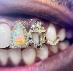 Grills Aesthetic, 90s Guys, Street Style 90s, Photoshoot Street, Women Street Style, Dental Jewelry, Grillz Teeth, Diamond Grillz, Streetwear Jewelry