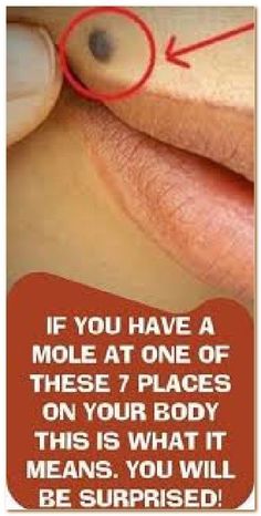 IF YOU HAVE A MOLE IN ONE THESE 6 PLACES ON BODY,IT MEANS. Healthy Woman