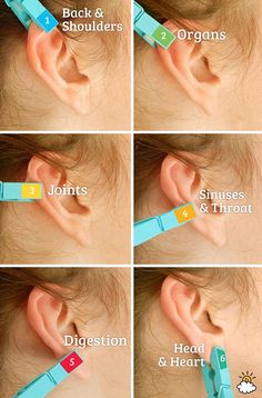 This incredible pain relief method is as simple as putting a clothespin on your ear. Health And Beauty Tips, Acupressure, Natural Medicine, Alternative Medicine, Massage Therapy, Acupuncture