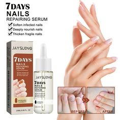 Directions for use: 1. washing nails with warm water,Soak your nails; 2. Removing Bad Armor and cleaning dirt from the surface of the nail; 3. apply an appropriate amount of 7 Days Nail Growth And Strengthening Serum to the bad nail; 4. Apply once during the day and once at night. Product Specifications: Name: 7 Days Nail Growth And Strengthening Serum Net weight: 10ml Shelf life: 3 years Storage: Store in a cool place Package includes: 1/2/3pcs  7 Days Nail Growth And Strengthening Serum Size: Nails Growth, Nails Repair, Cracked Nails, Nail Serum, Nail Problems, Ingrown Nail, Best Nails, Fungal Nail, Nail Repair