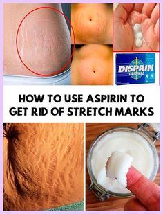 Strech Marks Removal, Essential Oils For Face, Homemade Scrub, Natural Hair Mask, Boost Hair Growth, Vicks Vaporub, روتين العناية بالبشرة