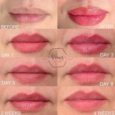 Lip Tattoo Healing Process, Lip Blush Healing Process, Lip Blushing Tattoo Before And After, Tattoo Healing Stages, Cosmetic Lip Tattoo