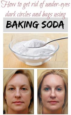 Baking Soda Under Eyes, Brown Spots On Hands, Obličejové Masky, Brown Spots On Face, Spots On Face, Baking Soda Shampoo, Under Eyes, Under Eye Bags, Beauty Remedies