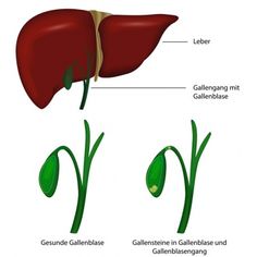 Galle – Aufbau, Funktion & Krankheiten | Medlexi.de Body Knowledge, Financial Markets, Stock Market