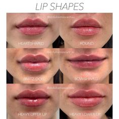 Lip Types, Being Unique