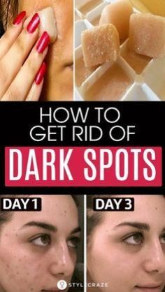 Discover simple and natural remedies to get rid of dark spots at home. Our guide offers effective solutions for reducing brown spots and achieving a more even skin tone. From anti-aging tips to beauty treatments, these home remedies help improve your skin care routine. Say goodbye to dark spots and hello to a brighter, radiant face with these easy and natural methods. Perfect for anyone looking to enhance their skin's appearance naturally. Dark Spots On Face, Brown Spots Removal, Brown Spots On Face, Spots On Face, Baking Soda Uses, Dark Under Eye, Wellness Inspiration, Skin Blemishes, Remove Dark Spots