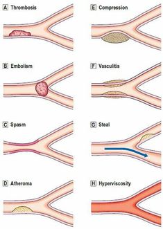 the different types of blood vessels in an animal's body and their corresponding structures