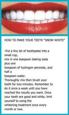 Baking Soda Teeth, Natural Teeth Whitening Diy, Baking Soda Teeth Whitening, Teeth Whitening Homemade, Teeth Whitening Remedies, Teeth Whitening Diy, Teeth Health, Natural Teeth Whitening, Natural Teeth