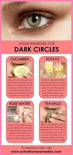 Remedies For Dark Circles, Fitness Corner, Coconut Oil Massage, Dark Circle Remedies, Natural Skin Care Remedies, Basic Skin Care, Diy Skin Care Routine, Natural Face Skin Care, Good Skin Tips