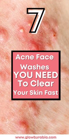 Looking for an acne face wash that actually works? Check this pharmacist Guide on the best acne face wash acne face wash, acne face wash best, acne face wash for sensitive skin, face wash for acne prone skin, face wash for acne, face wash for acne and oily skin, cleanser for acne, acne skincare routine, how to treat acne at home, salicylic acid cleanser, face wash for cystic acne, Painful Acne