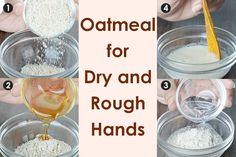 How to Soften Rough and Cracked Hands: 8 Home Remedies Rough Hands Remedy, Hand Soak For Dry Hands Diy, Hand Soak For Dry Hands, Dry Hands Remedy Overnight, Chapped Hands Remedy, Dry Skin Home Remedies, Extremely Dry Hands