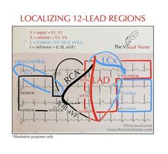 an image of a medical diagram with the words localizing 12 - lead regions on it