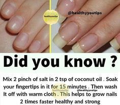 Grow Long Nails, Nail Growth Tips, Grow Nails Faster, Nails Homecoming, Nail Care Routine, Nail Care Tips, How To Grow Nails, Brittle Nails, Nail Art Instagram