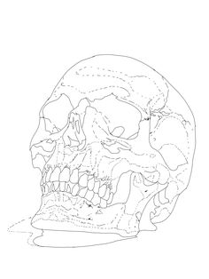 a black and white drawing of a skull with its teeth missing from the front view