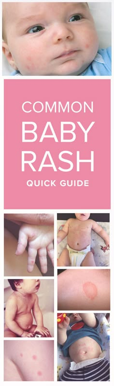 a baby's face and hands with the words, common baby bash quick guide