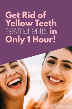 zoom teeth whitening, zoom teeth before and after, zoom teeth whitening before and after, whiten teeth fast, at home whitening, in office whitening, whiten teeth, whiten teeth with hydrogen peroxide