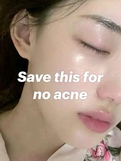 Save this pin to get rid of acne 🌸 What Helps Acne, Save This Pin For Clear Skin, How To Get Clear Skin Quickly, Tips To Get Rid Of Acne, How To Help Acne, No Acne Clear Skin, Acne Skin Aesthetic, How To Get Rid Of Chin Acne, Ways To Get Rid Of Acne