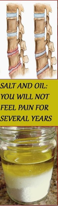 SALT and OIL: Medicinal mixture… you will not feel pain for several years.... Homemade Remedies, Natural Home Remedies, Sciatica, Health And Beauty Tips, Natural Medicine, Herbal Medicine, Health Remedies, Herbal Remedies, Natural Healing