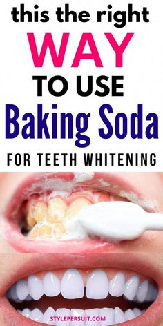 How To Use Baking Soda To Whiten Your Teeth: if you want to explore natural teeth whitening treatments, baking soda is a great option. Read on to know more about the benefits of using baking soda to get pearly white teeth. #teethwhitening #whiteteeth #remedies #homeremedies White Teeth Baking Soda, Natural Remedies For Cavities, Pearly White Teeth, Gut Healing Recipes