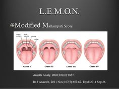 the mouth and tongue are labeled in this diagram