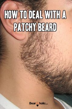 Patchy Beard, Beard Care Products, Beard Man, Thick Beard, Bald With Beard, Beard Game, Perfect Beard