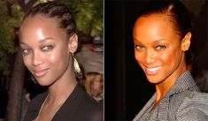 Tyra Banks battles thinning hair | Stuff.co.nz Receding Hairline, Womens Hair, Thinning Hair, Hair Stuff, Hair Piece, How To Feel Beautiful, Hair Pieces