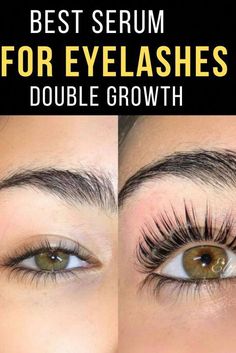 Have you been looking for a lash serum that REALLY WORKS? Buy Careprost – a revolutionary solution that stimulates eyelash growth making them long and voluminous in just a few weeks! BUY CAREPROST ONLINE AT AFFORDABLE PRICE Long black full eyelashes are the goal of every woman who wants to look her best. Did you… Grape Diet, Diy Serum, Eyelash Growth Serum, Eyelash Serum, Eyelash Growth, Growth Serum, Eye Lashes, Longer Eyelashes, Belleza Natural