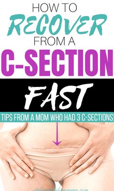 The Do's and Don'ts After a C-section - italianpolishmomma.com Postpartum Cesarean