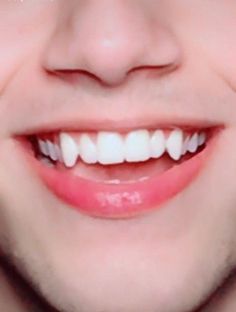 a close up of a person's mouth with white teeth