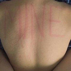 the back of a woman with red marks on her chest