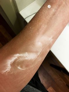 a person's arm with white spots on it and water running down the side