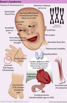 the anatomy of an infant's head and neck