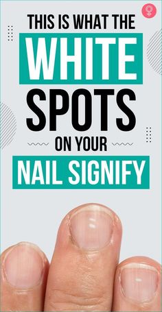 This Is What The White Spots On Your Nail Signify Moons On Fingernails, White Marks On Nails, White Spots On Nails, Fingernail Health, Health Nails, Nail Problems, Nails Healthy