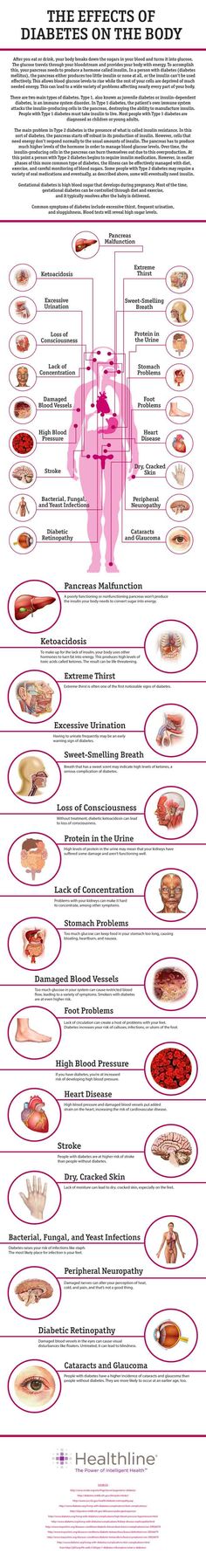 The Effects of Diabetes on the Body Nursing Tips, Nursing Study, Nursing Notes, Nursing Education, Endocrine System, Anatomy And Physiology, Medical Information, Health Info, Nursing Students