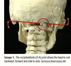 Clients presenting with occipital neuralgia commonly complain of pain referring up the back of the head and around the side. Neck Spasms, Sensory Organs, Punkty Spustowe, Neck Headache, Natural Migraine Relief, Occipital Neuralgia, Headache Relief Instant, Natural Headache, Headache Prevention