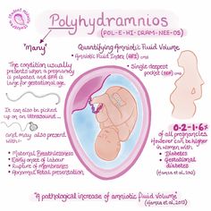 the diagram shows how polyhydraamios are used for breasting and diapering