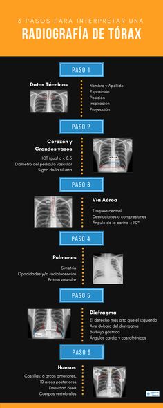 the back side of a poster showing different types of radiographs and their corresponding features